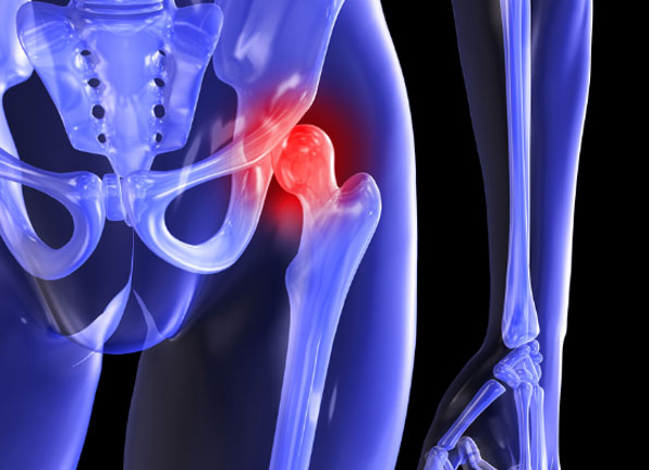 Hip arthroscopy