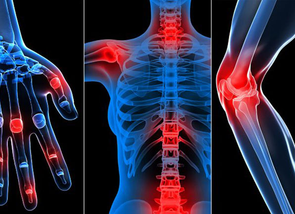 Bone or Joint Infections and Tumors