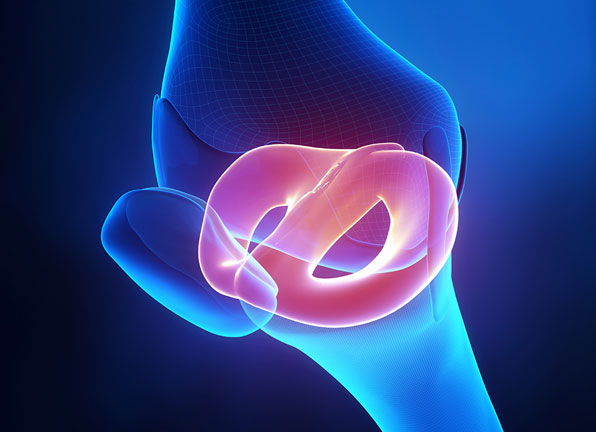 Meniscus Repair Surgery