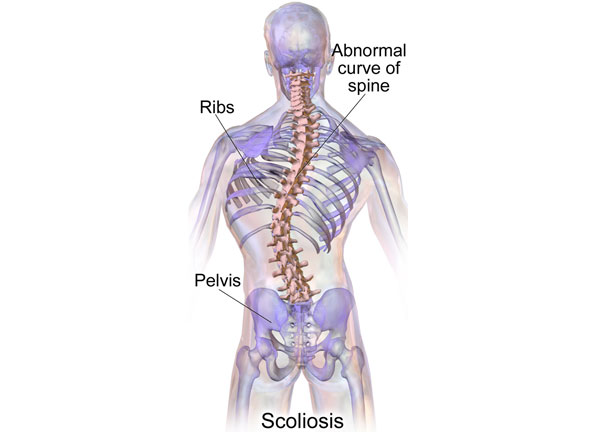 Spine and Rib-Based Growing-Rod Operation